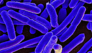 E.coli Expression Services