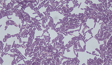 Bacillus Subtilis Expression Services